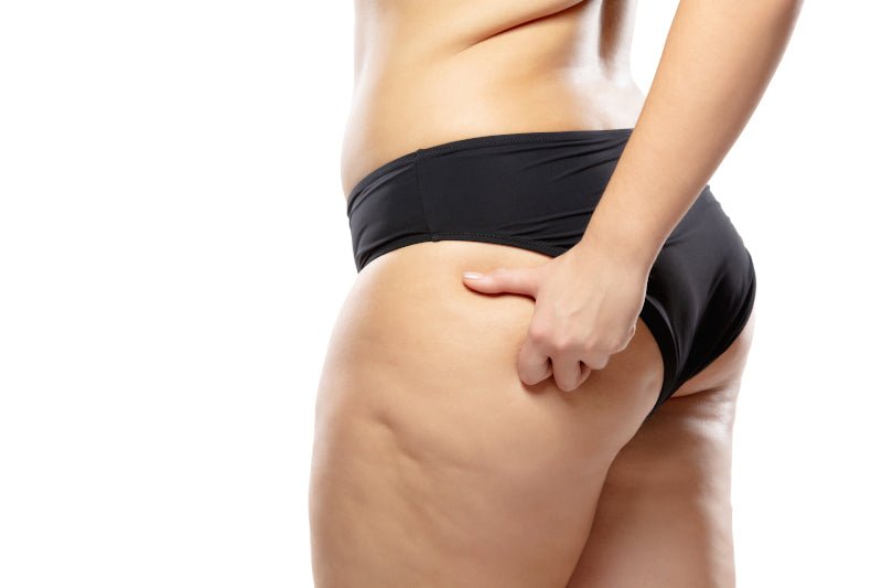 How to get rid of saddlebags using Compex electrostimulation