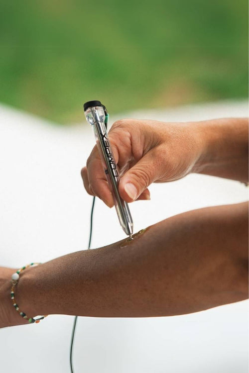 A woman finding optimal electrode placement on her forearm, using the Compex Motor Point Pen