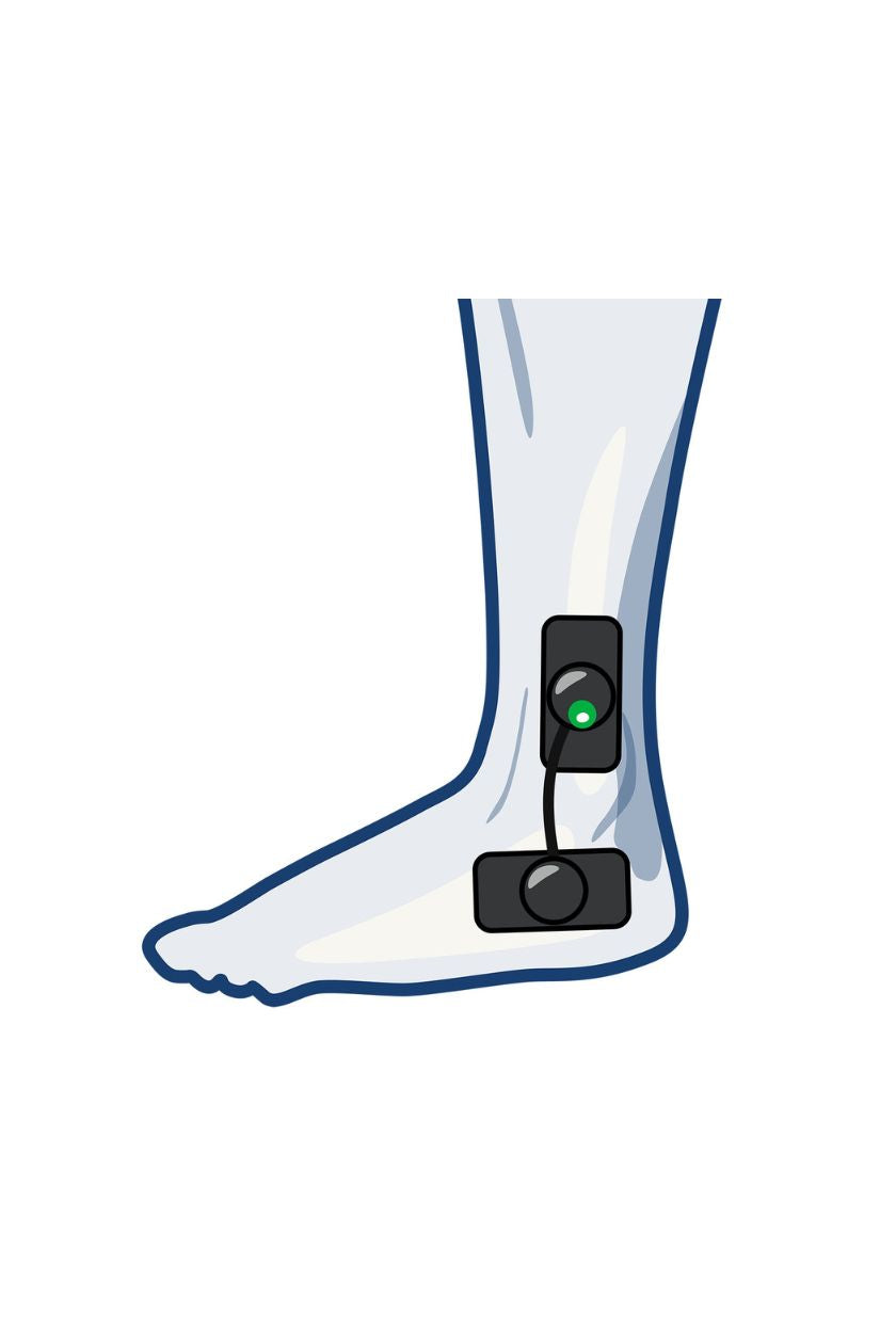 Ankle electrode placement for men with wireless Compex EMS muscle stimulator
