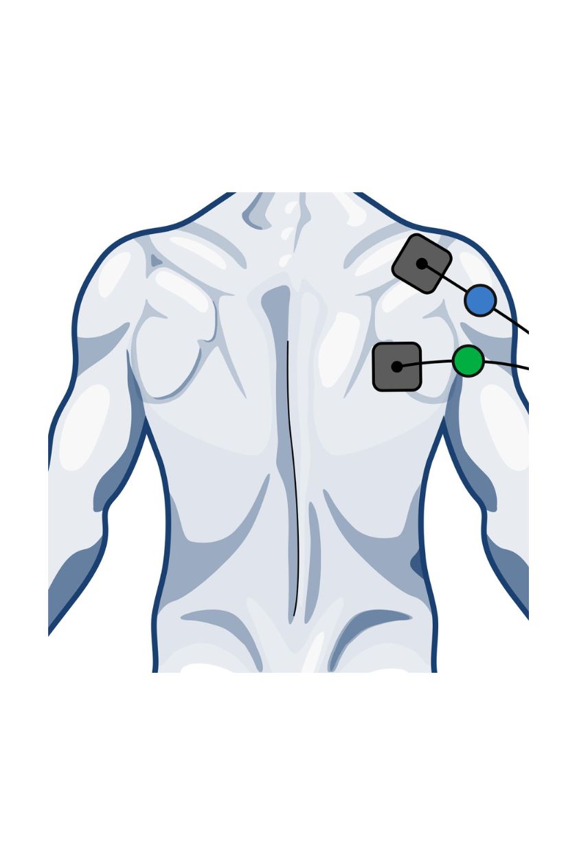 Back (high) electrode placement for men with wired Compex EMS muscle stimulator