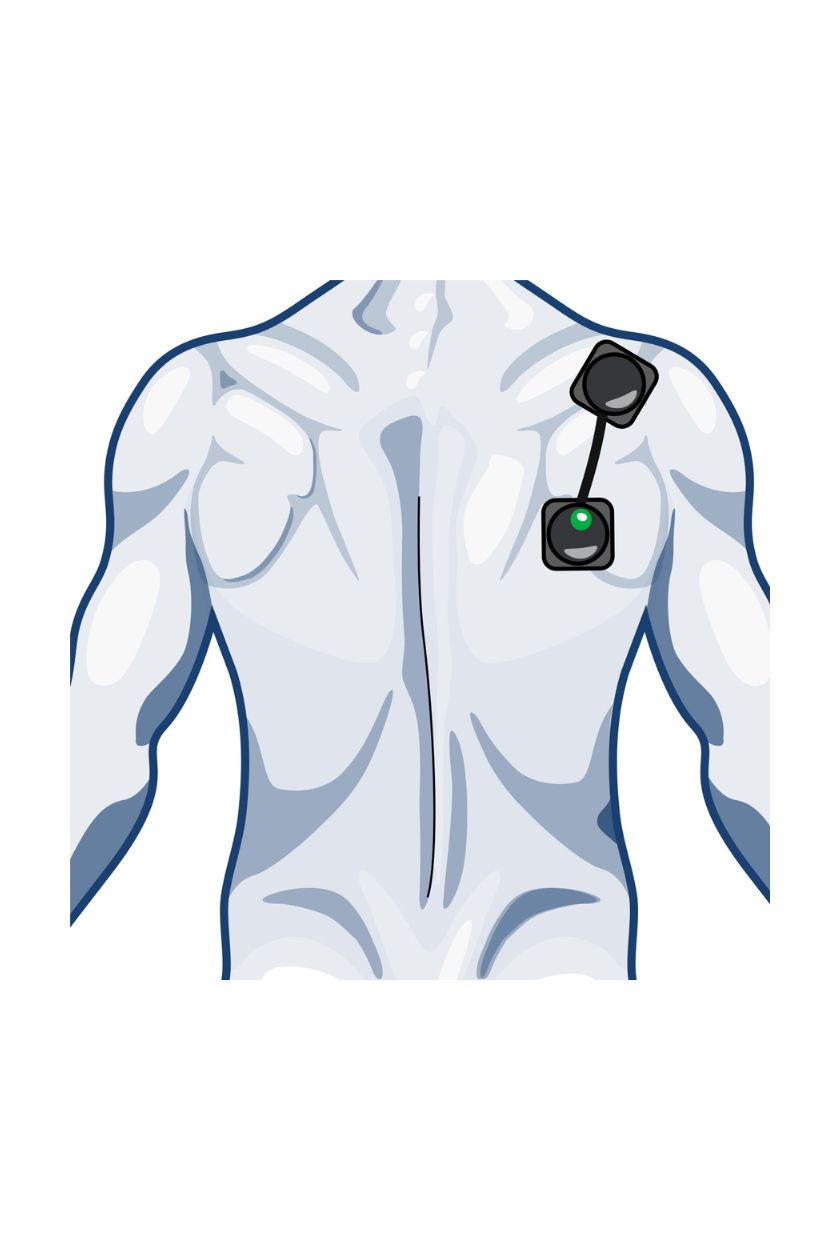 Back (high) electrode placement for men with wired Compex EMS muscle stimulator