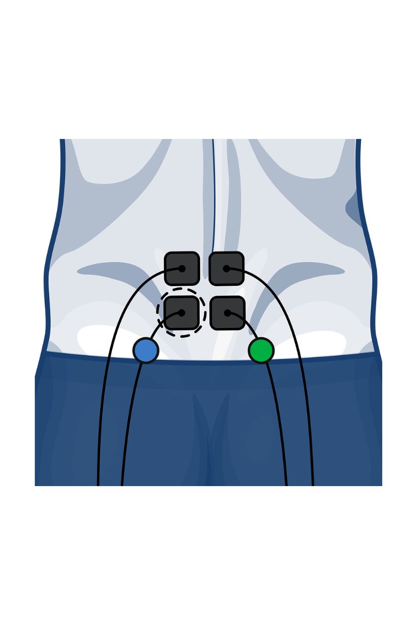 Back (lower) electrode placement for men with wired Compex EMS muscle stimulator