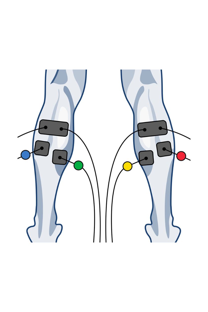 4 channel calf electrode placement for men with wired Compex EMS muscle stimulator