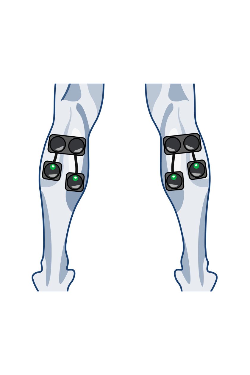 4 channel calf electrode placement for men with wireless Compex EMS muscle stimulator