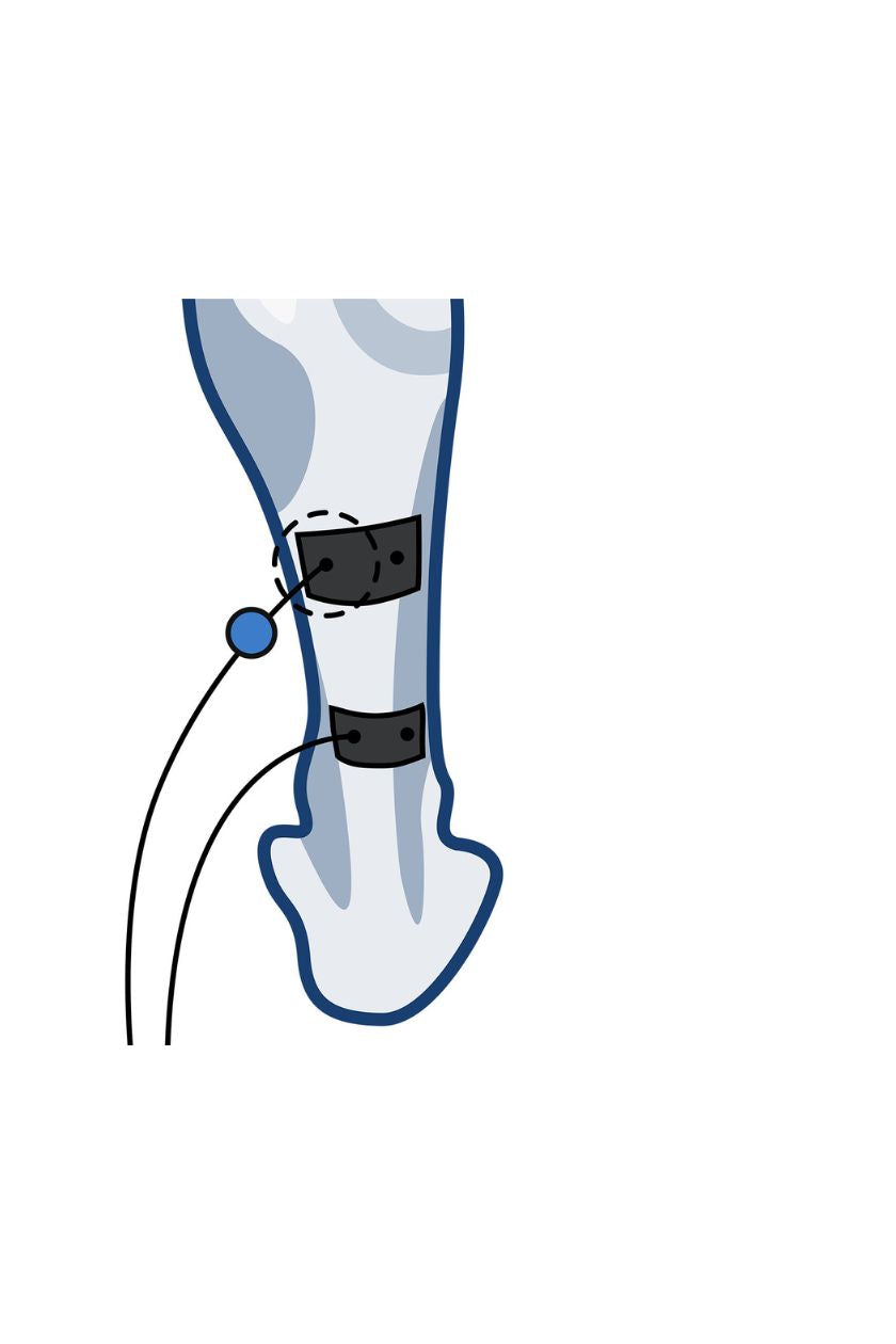 Calf (low) electrode placement for men with wired Compex EMS muscle stimulator