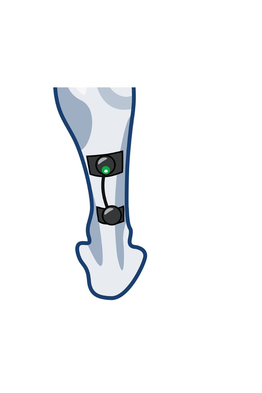 Calf (lower) electrode placement for men with wireless Compex EMS muscle stimulator