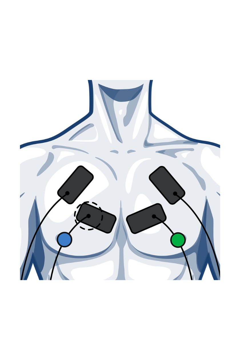 Chest electrode placement for men with wired Compex EMS muscle stimulator