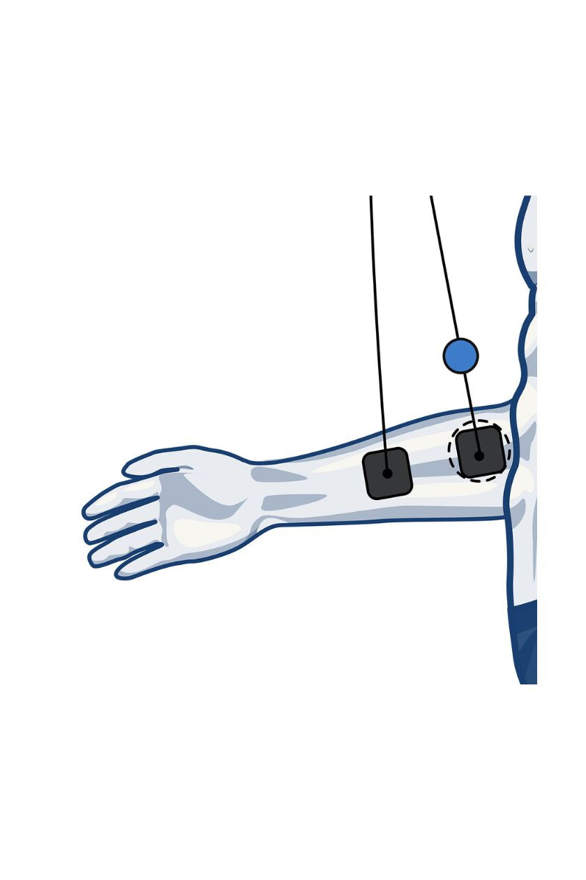 Forearm (inside) electrode placement for men with wired Compex EMS muscle stimulator