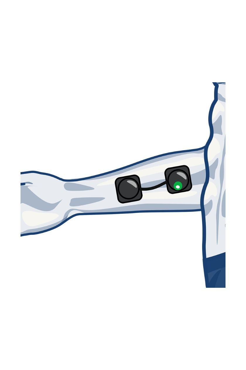 Forearm (inside) electrode placement for men with wireless Compex EMS muscle stimulator