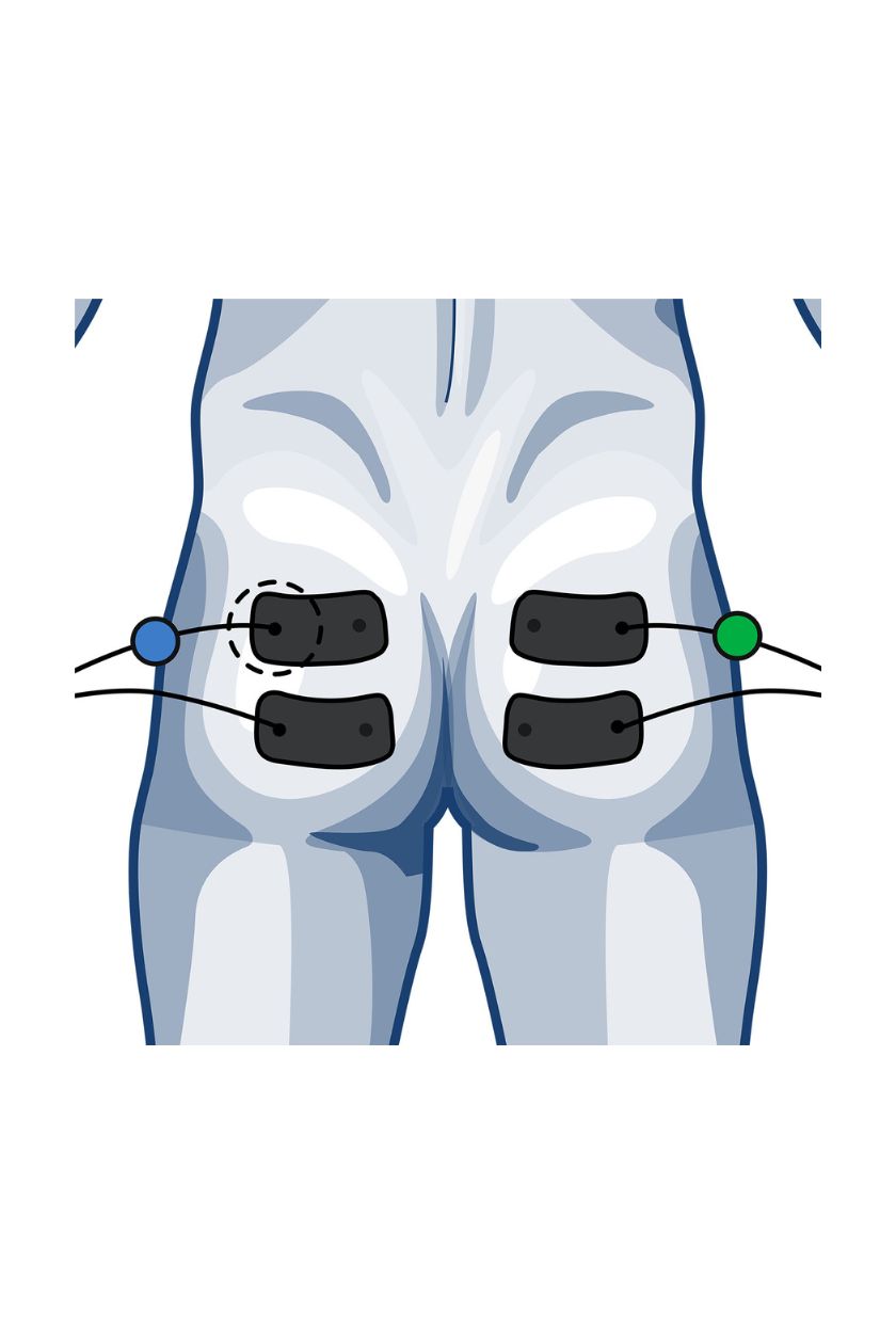 2 channel glute electrode placement for men with wired Compex EMS muscle stimulator