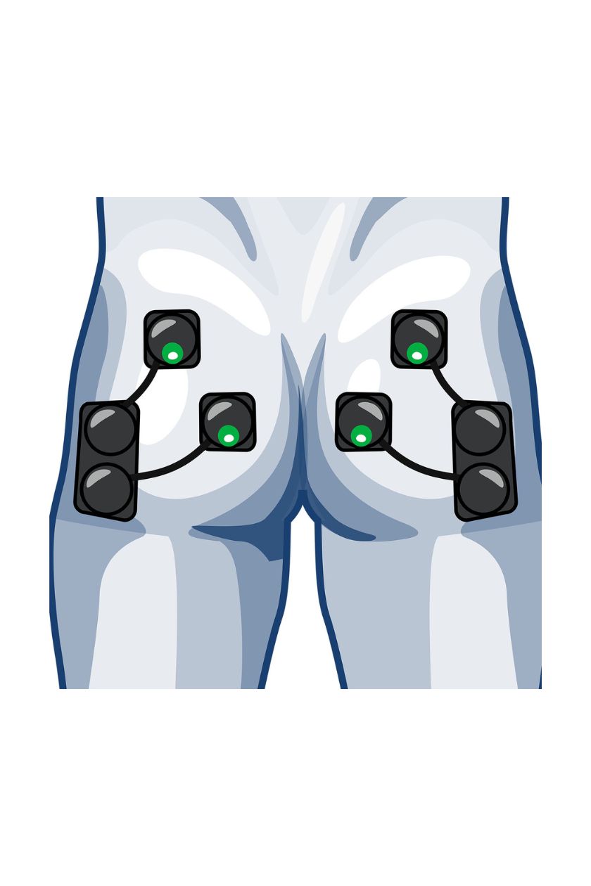 4 channel glutes electrode placement for men with wireless Compex EMS muscle stimulator