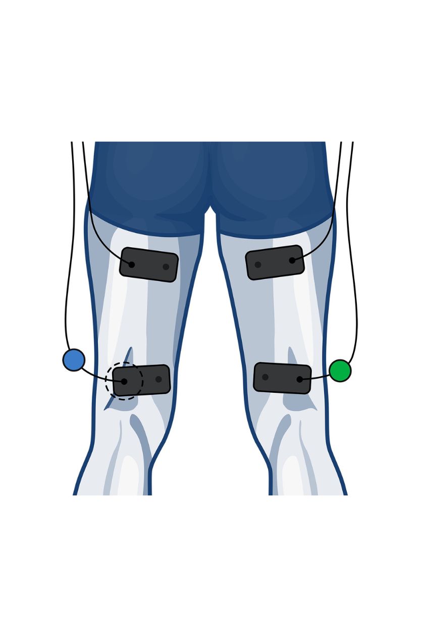 2 channel hamstring electrode placement for men with wired Compex EMS muscle stimulator