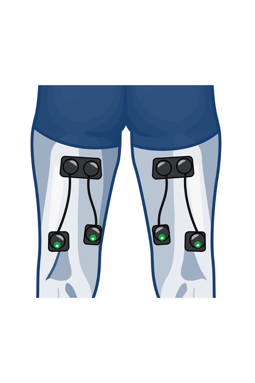 4 channel hamstring electrode placement for men with wireless Compex EMS muscle stimulator