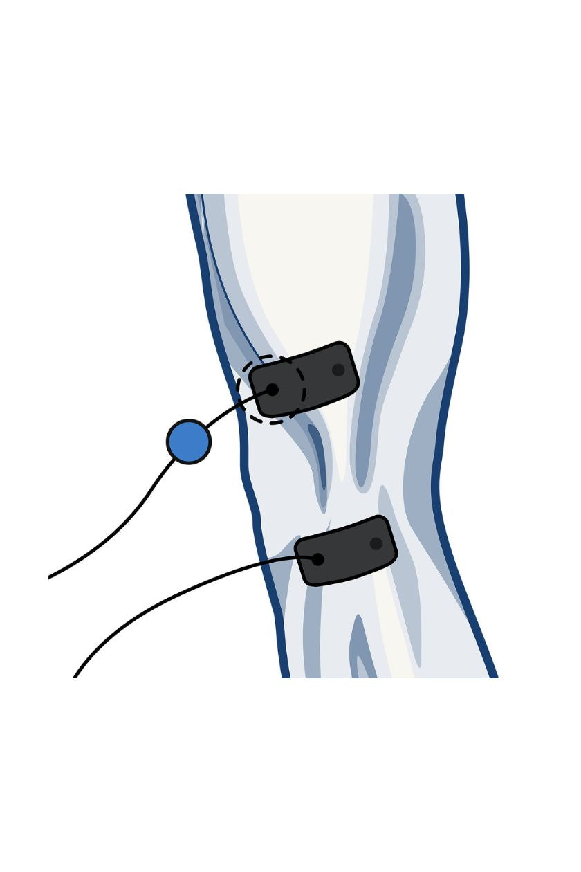 Knee (outside) electrode placement for men with wired Compex EMS muscle stimulator