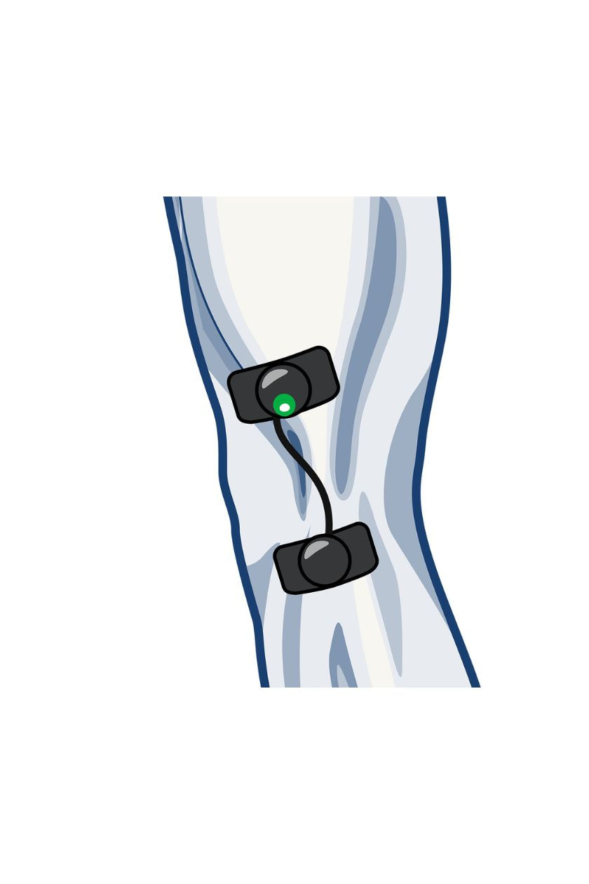 Knee (outside) electrode placement for men with wireless Compex EMS muscle stimulator
