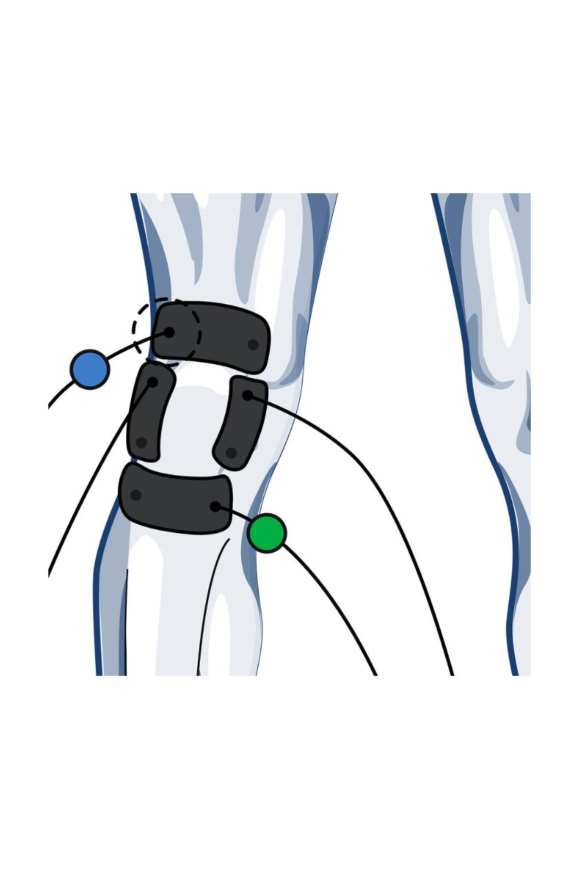 Knee electrode placement for men with wired Compex EMS muscle stimulator