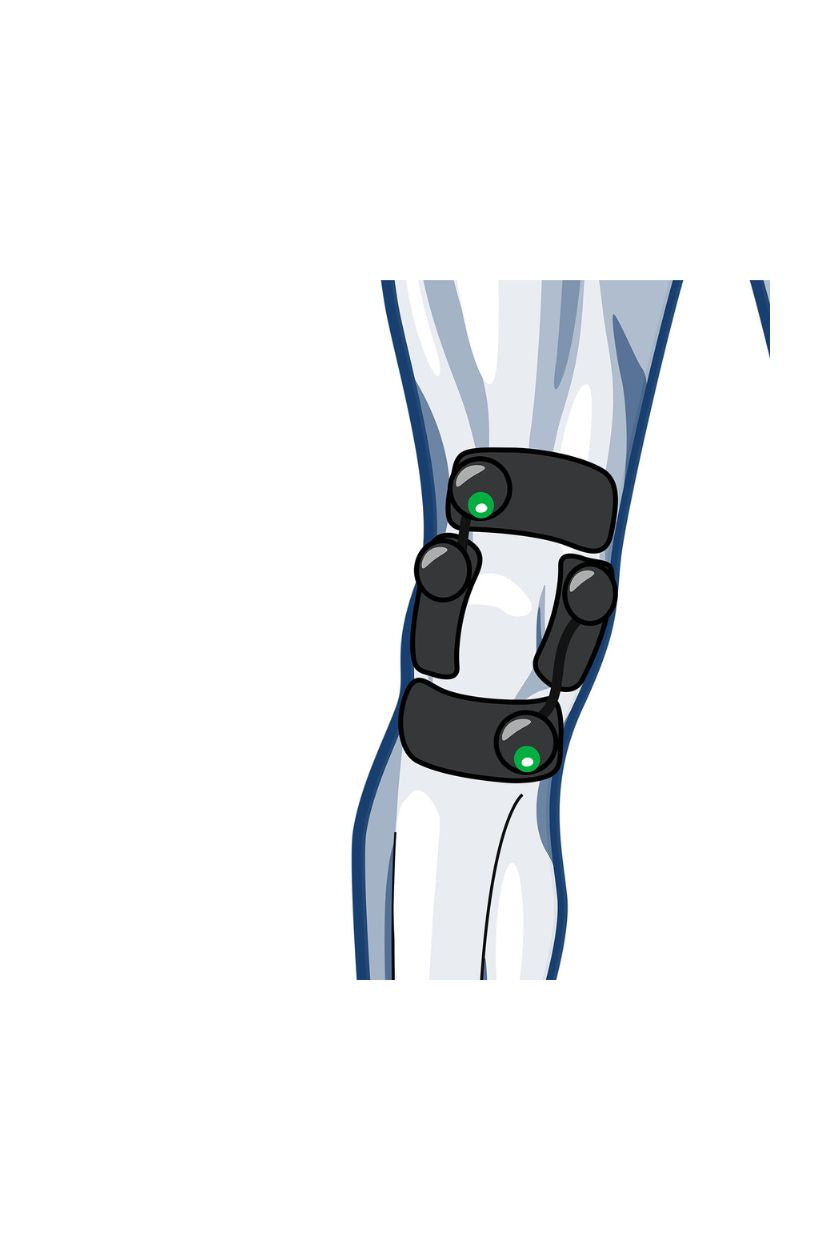 Knee electrode placement for men with wireless Compex EMS muscle stimulator