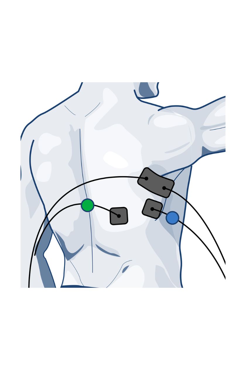Lats electrode placement for men with wired Compex EMS muscle stimulator