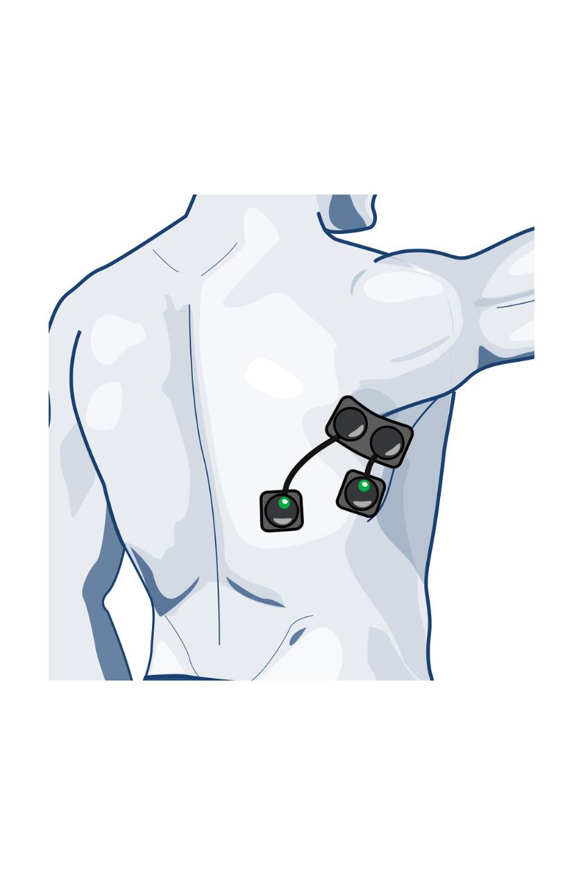 Lats electrode placement for men with wired Compex EMS muscle stimulator