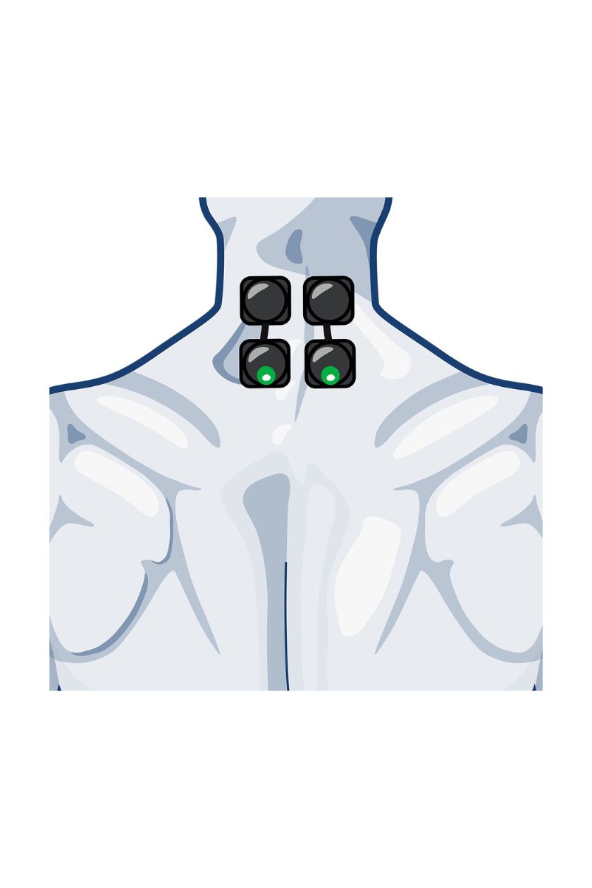 Neck electrode placement for men with wireless Compex EMS muscle stimulator