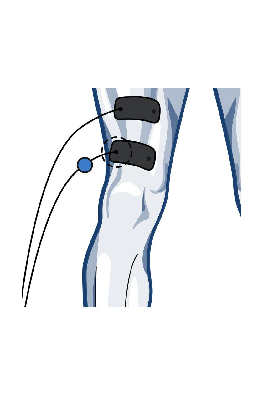 Quad (low) electrode placement for men with wired Compex EMS muscle stimulator