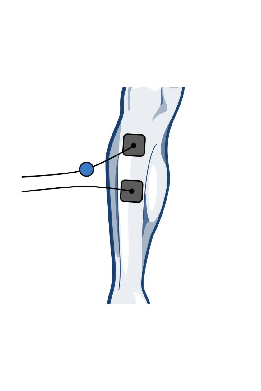 Shin electrode placement for men with wired Compex EMS muscle stimulator