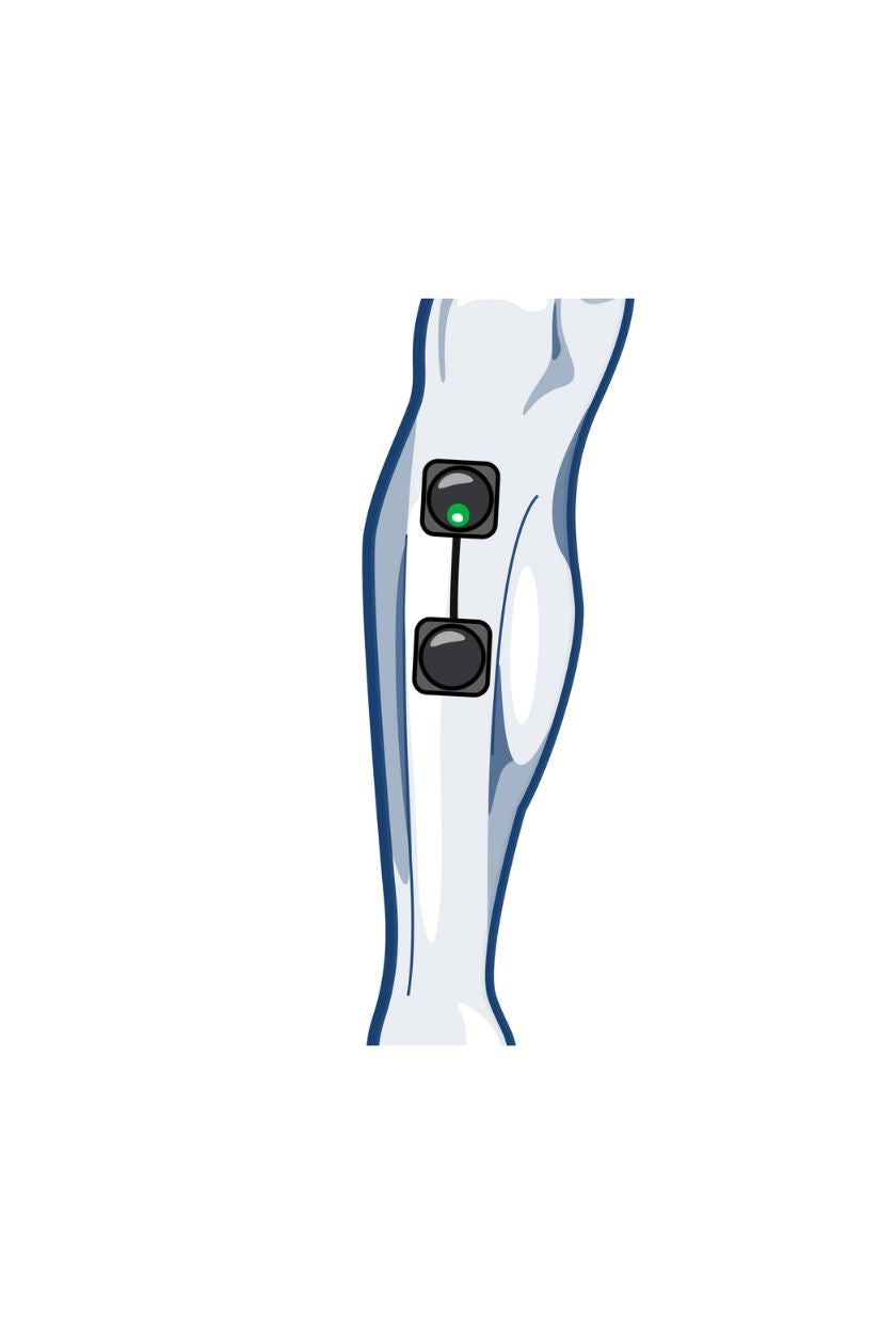 Shin electrode placement for women with wireless Compex EMS muscle stimulator
