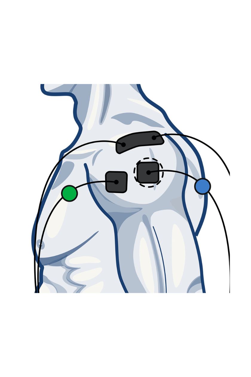 2 channel shoulder electrode placement for men with wired Compex EMS muscle stimulator