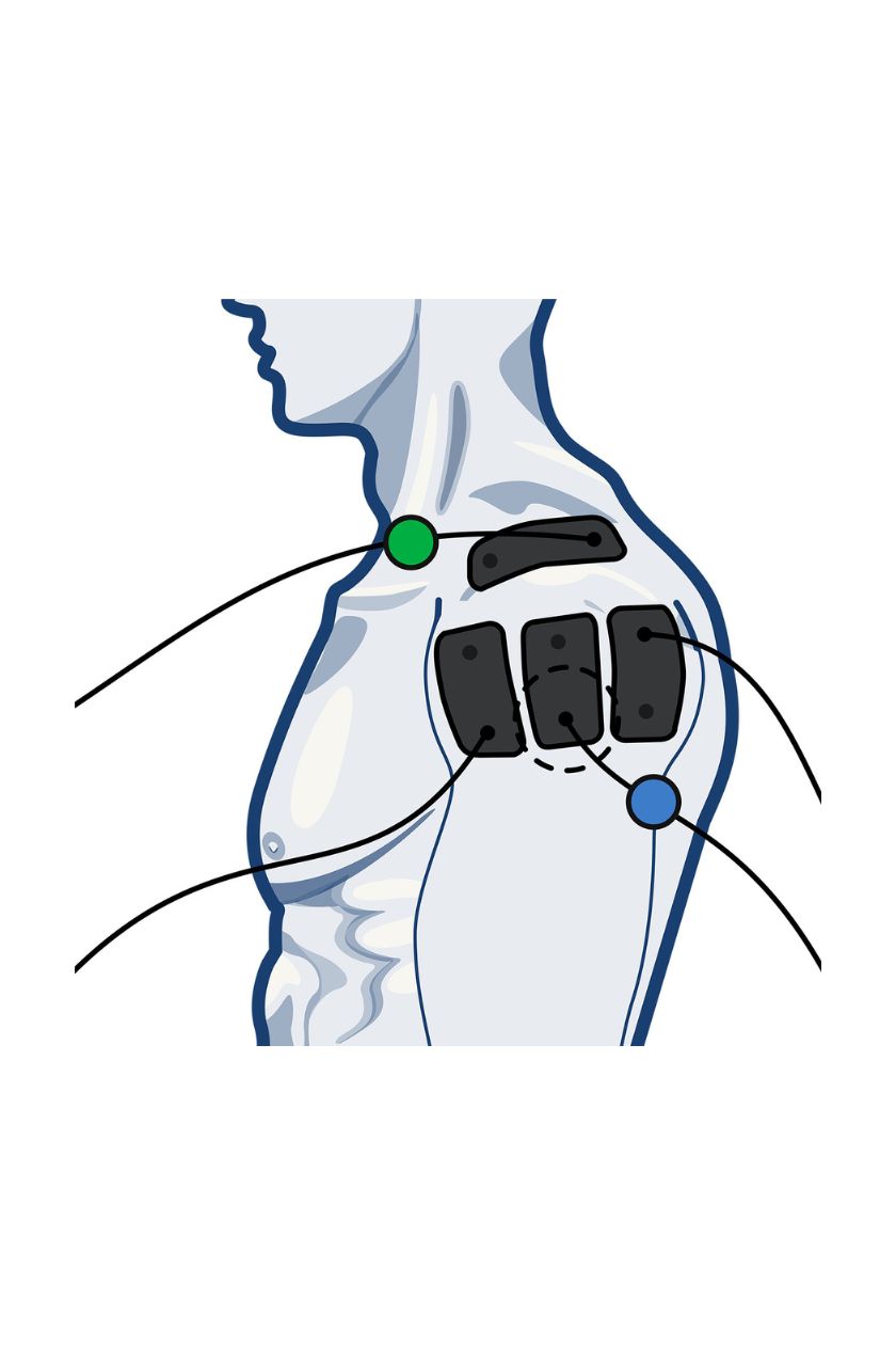 4 channel shoulder electrode placement for men with wired Compex EMS muscle stimulator