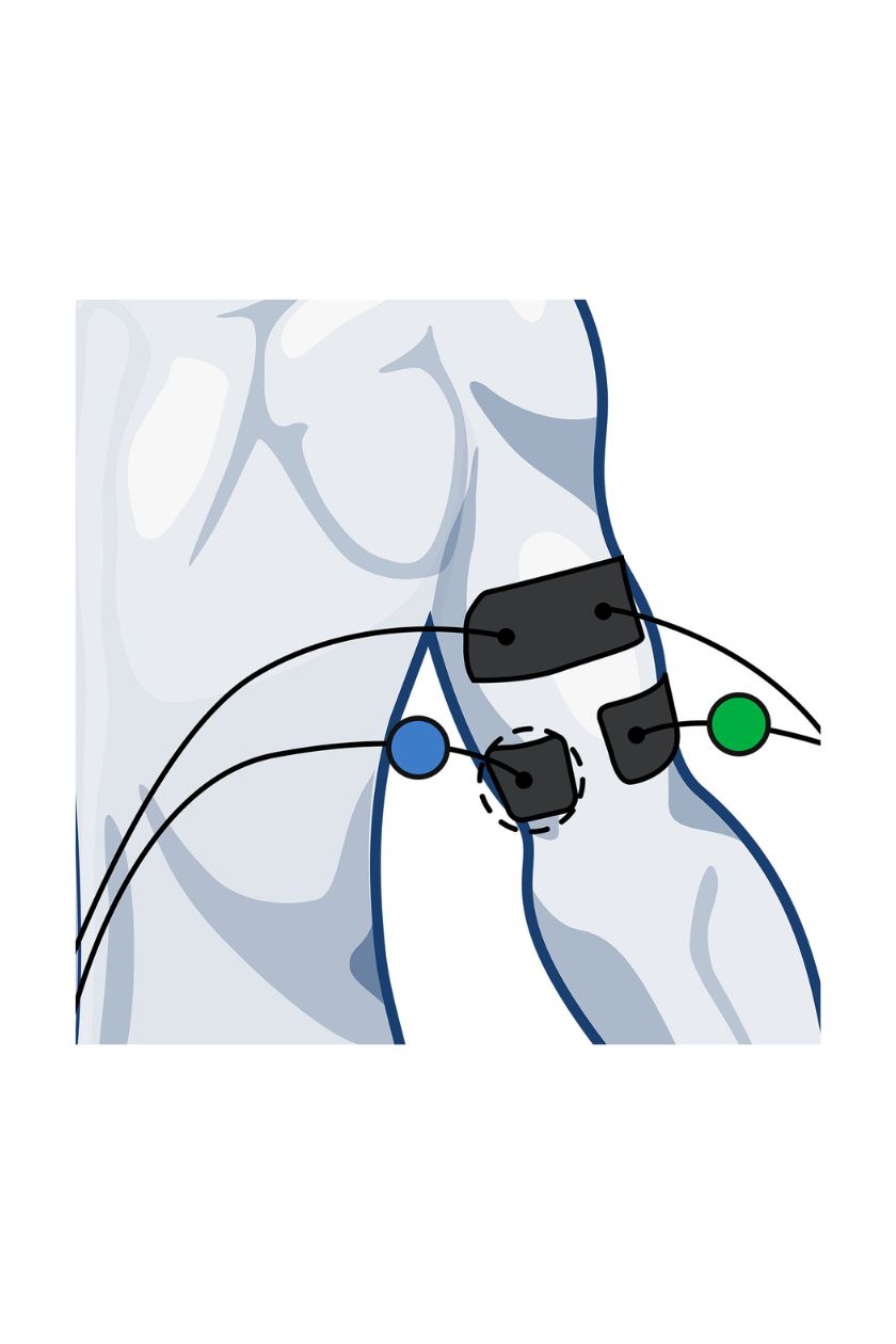Tricep electrode placement for men with wired Compex EMS muscle stimulator