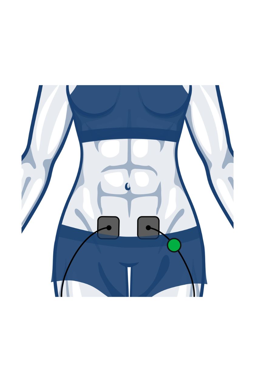 Ab (period pain) electrode placement for women with wired Compex EMS muscle stimulator