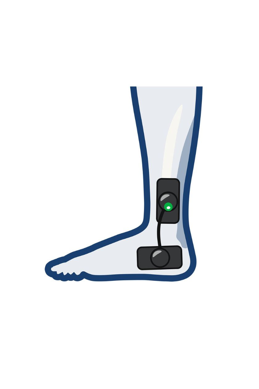Ankle electrode placement for women with wireless Compex EMS muscle stimulator