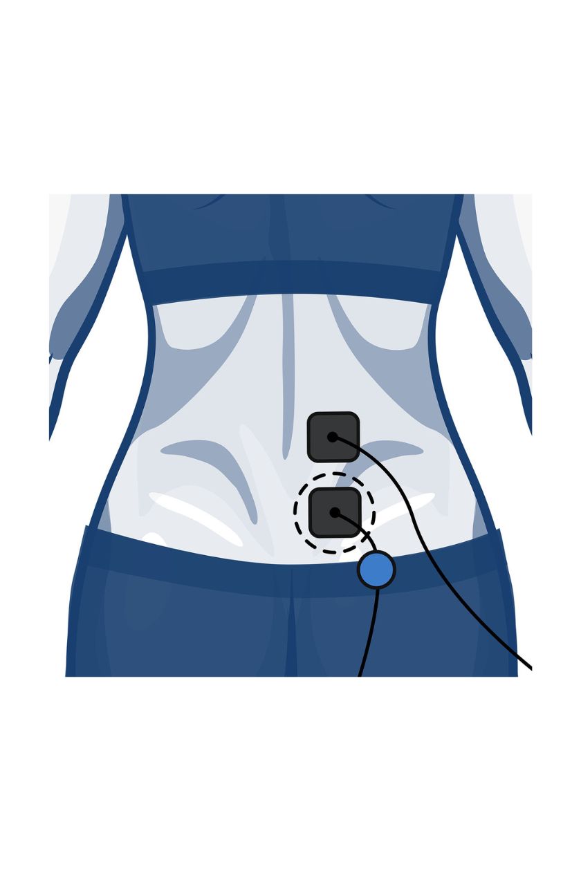 Back (half) electrode placement for women with wired Compex EMS muscle stimulator