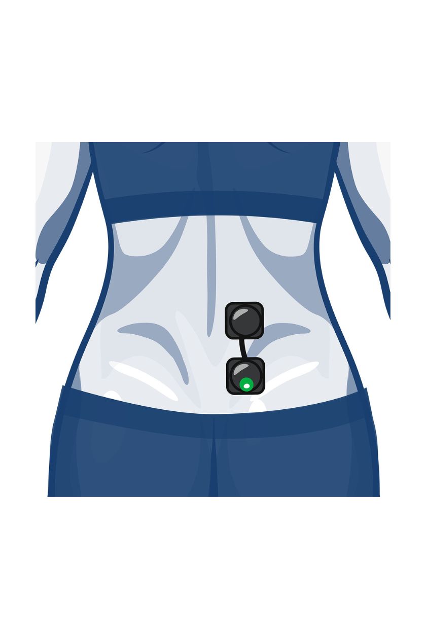 Back (half) electrode placement placement for women with wireless Compex EMS muscle stimulator