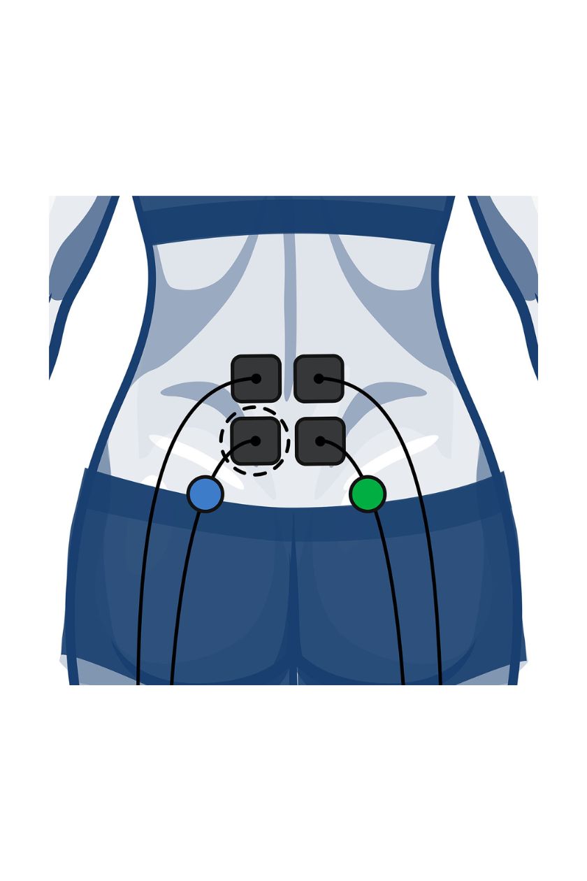Back (lower) electrode placement for women with wired Compex EMS muscle stimulator