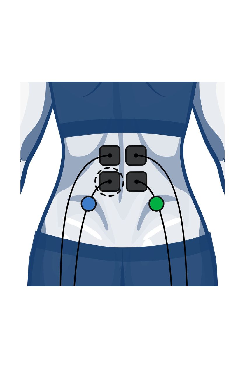 Back (upper) electrode placement for women with wired Compex EMS muscle stimulator