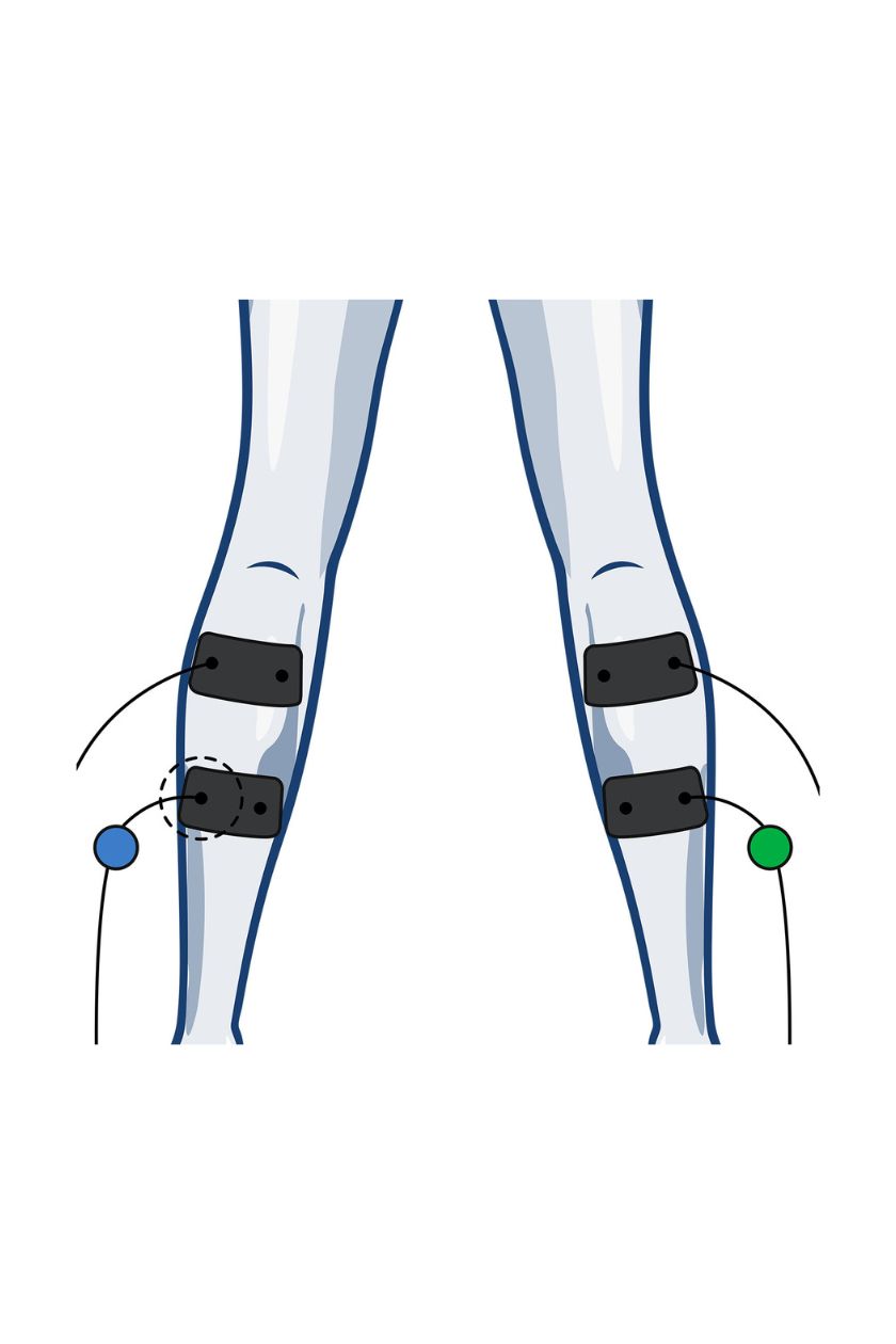 2 channel calf electrode placement for women with wired Compex EMS muscle stimulator