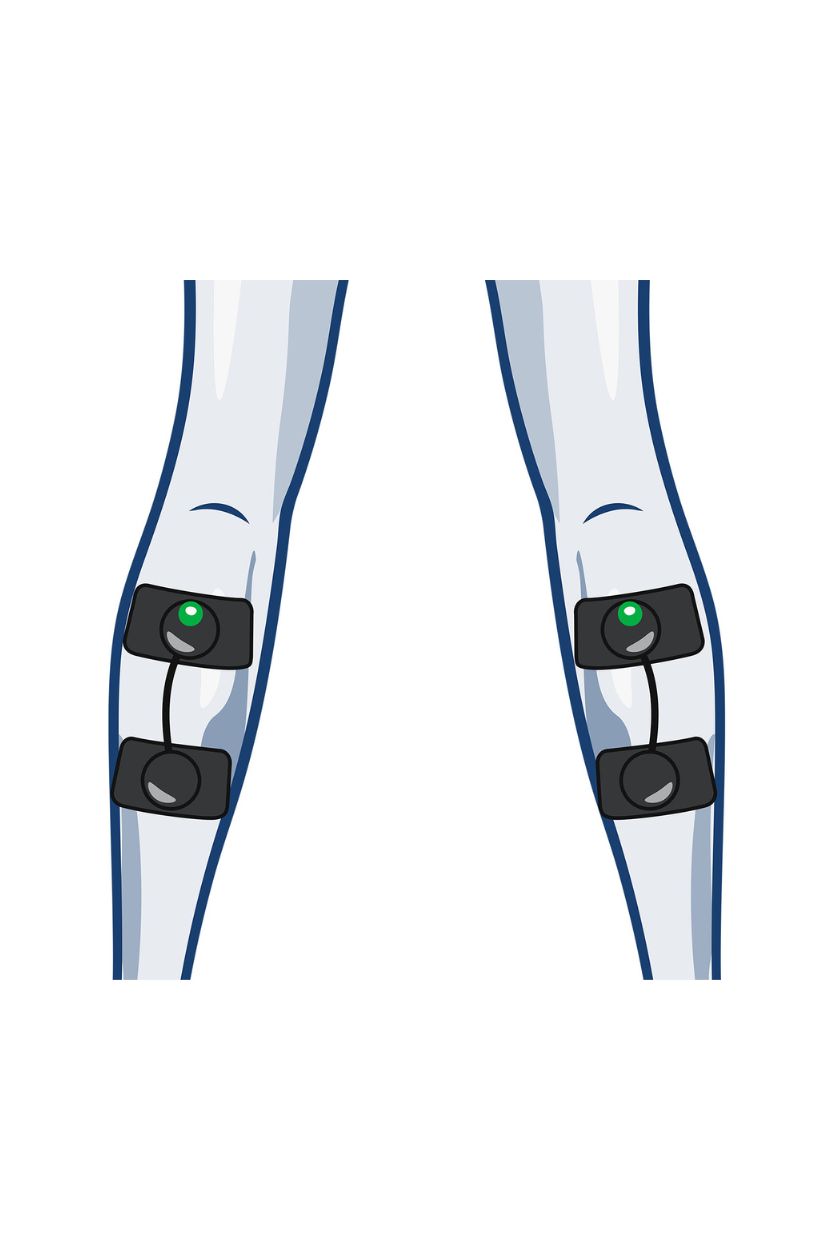 2 channel calf electrode placement for women with wireless Compex EMS muscle stimulator