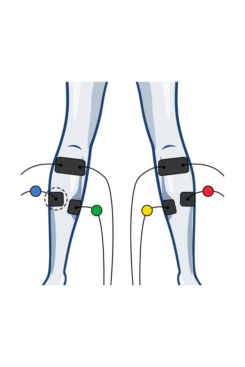 4 channel calf electrode placement for women with wired Compex EMS muscle stimulator
