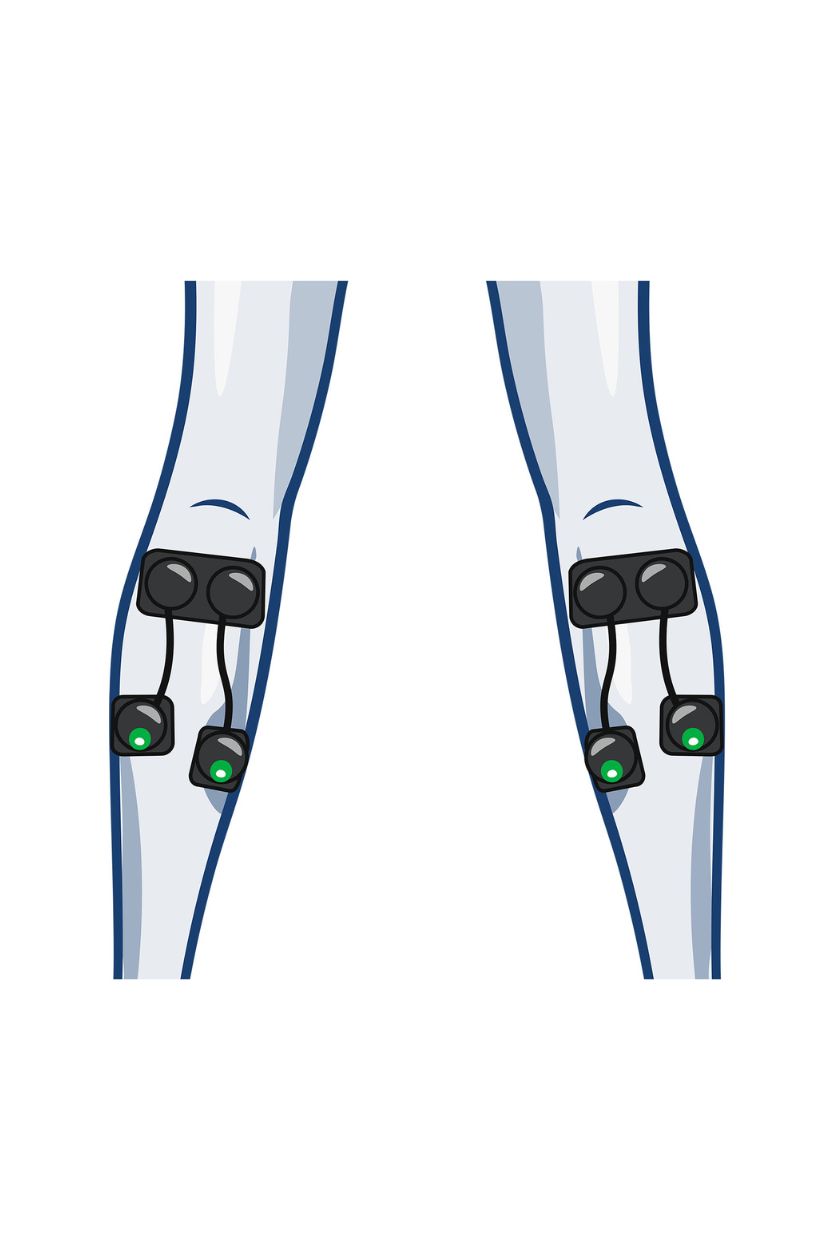 4 channel calf electrode placement for women with wireless Compex EMS muscle stimulator