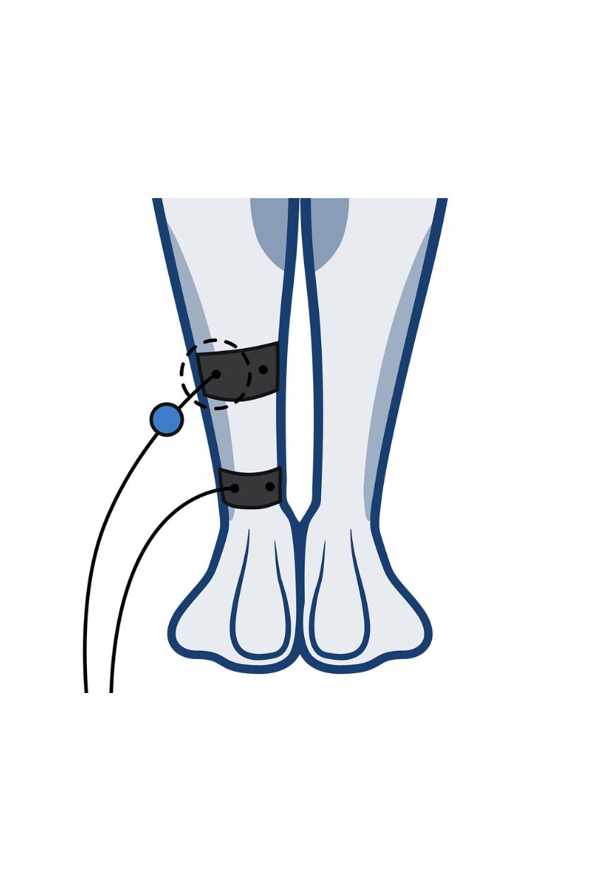 Calf (low) electrode placement for women with wired Compex EMS muscle stimulator