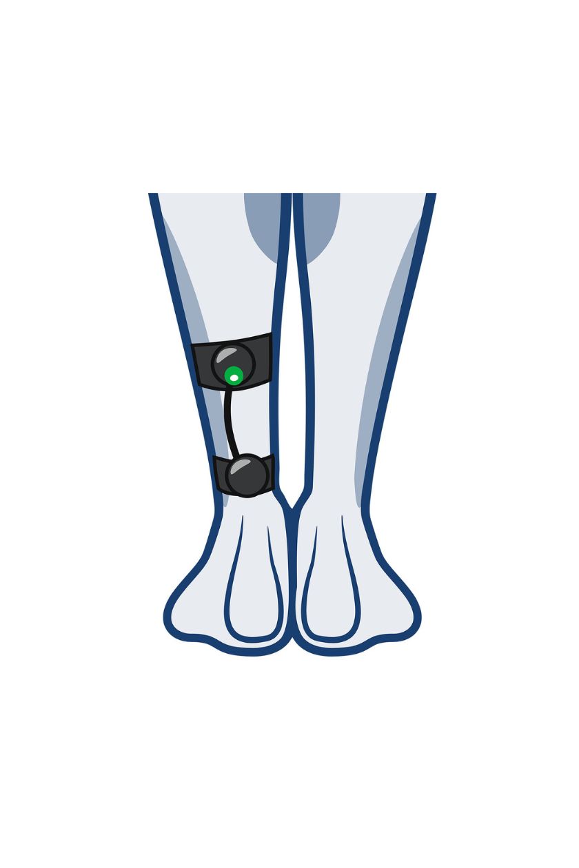 Low calf electrode placement for women with wireless Compex EMS muscle stimulator