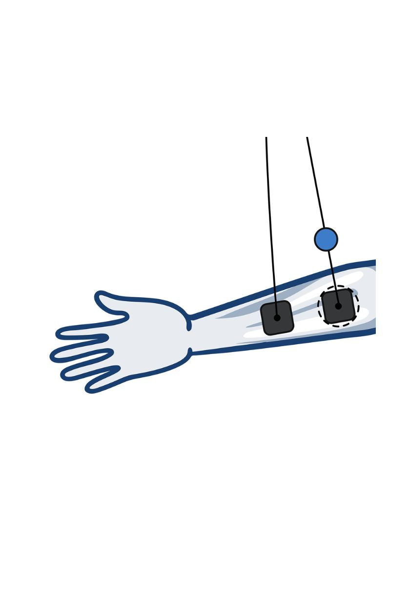Forearm (inside) electrode placement for women with wired Compex EMS muscle stimulator
