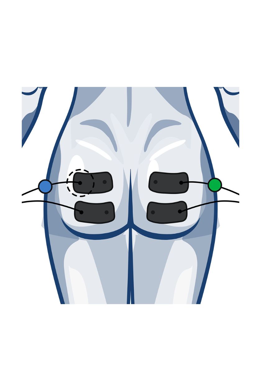 2 channel glute electrode placement for women with wired Compex EMS muscle stimulator