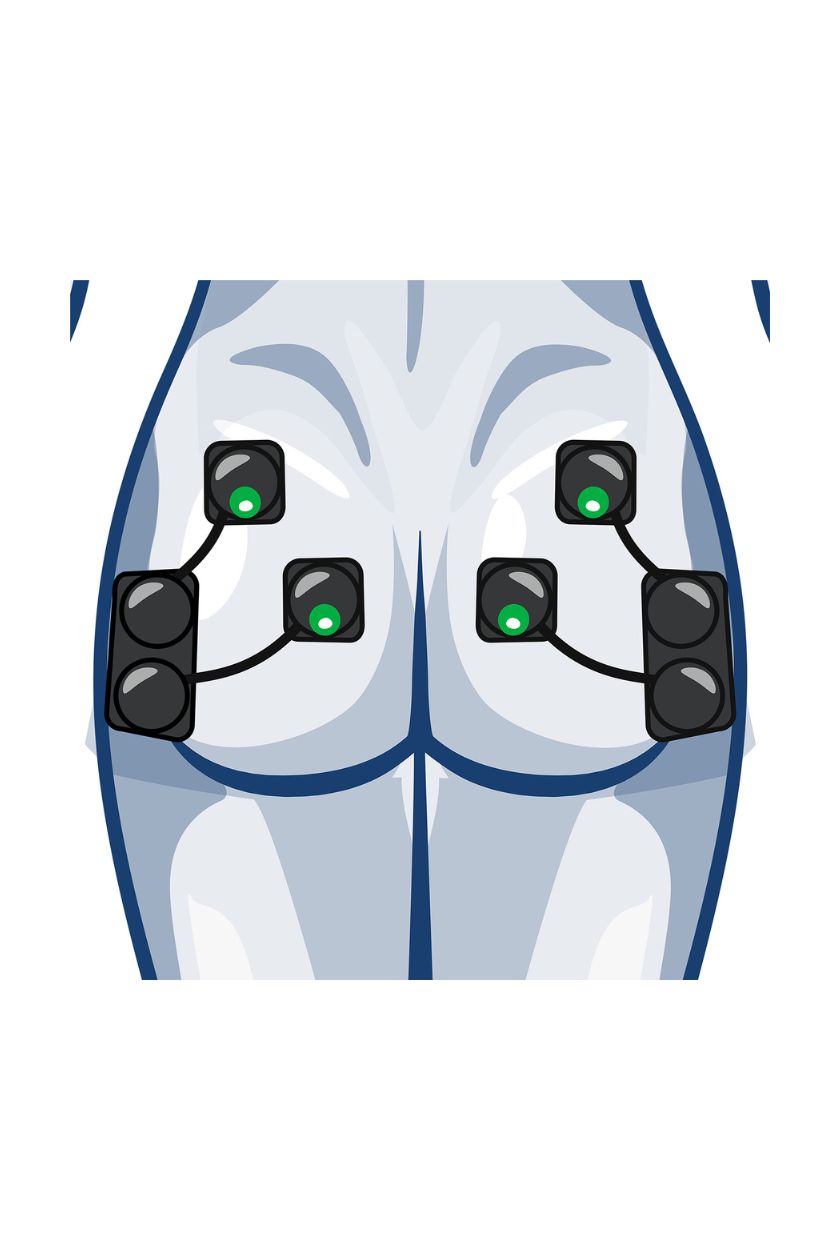 Glutes (4 channels) electrode placement for women with wireless Compex EMS muscle stimulator