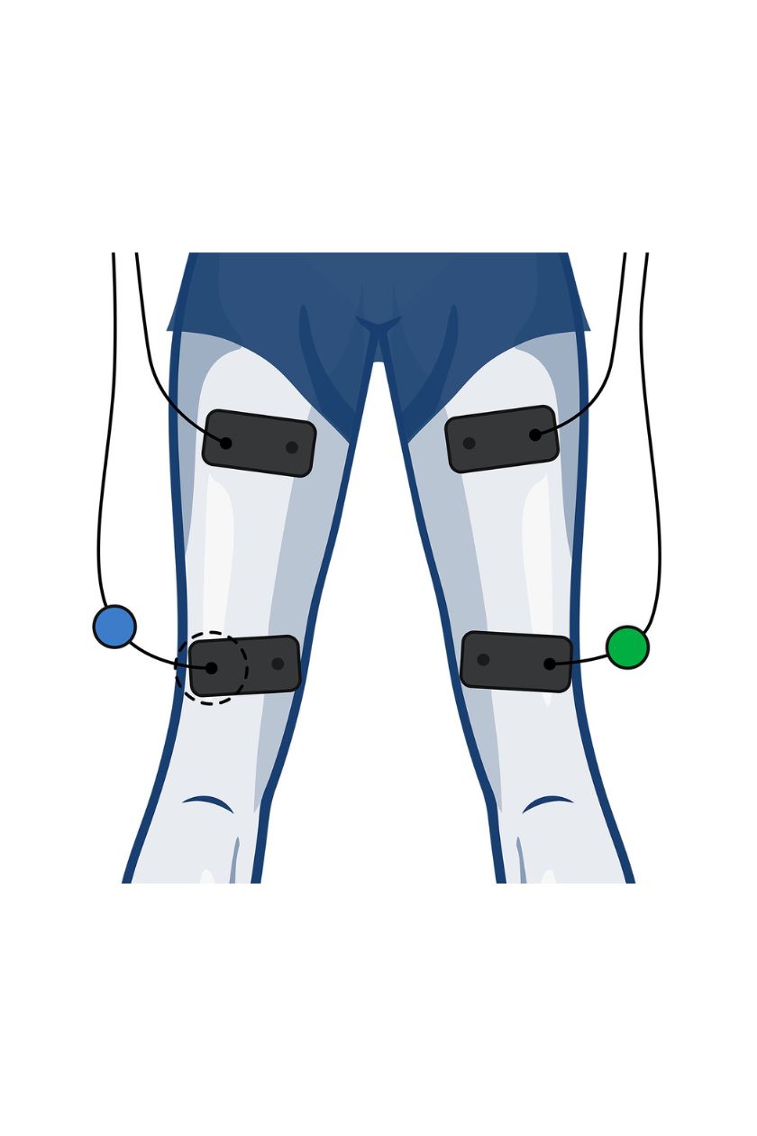 2 channel hamstring electrode placement for women with wired Compex EMS muscle stimulator