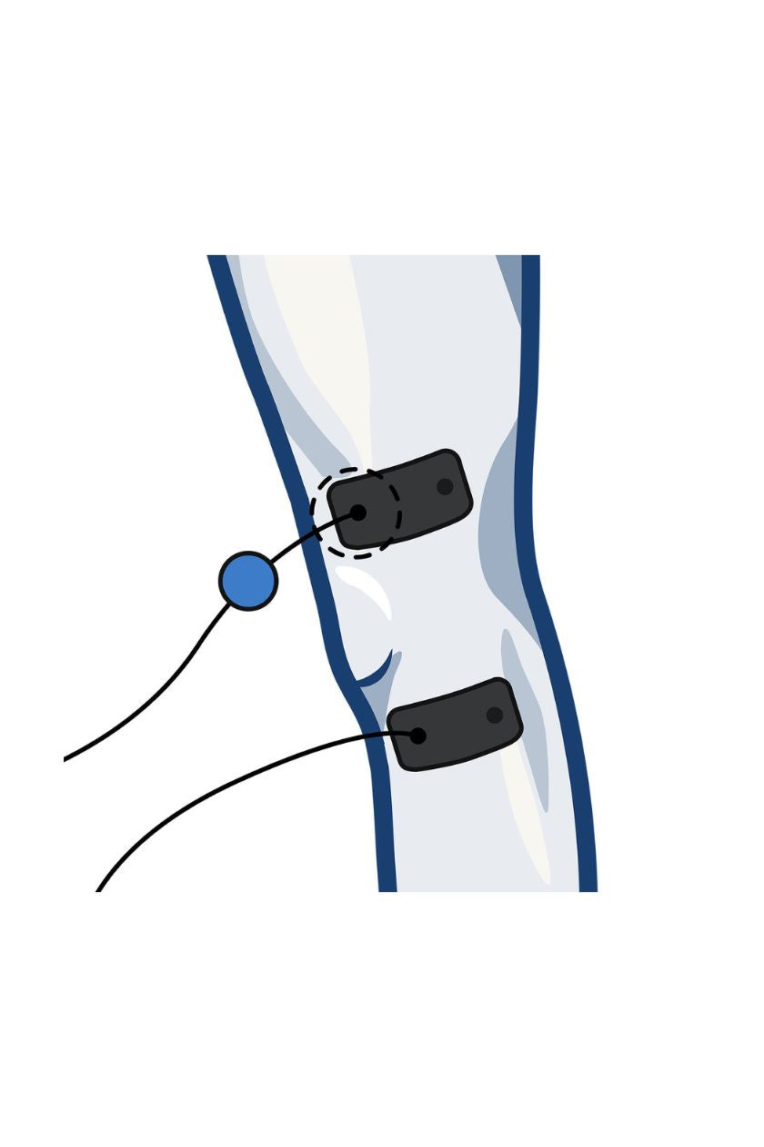 Knee (outside) electrode placement for women with wired Compex EMS muscle stimulator