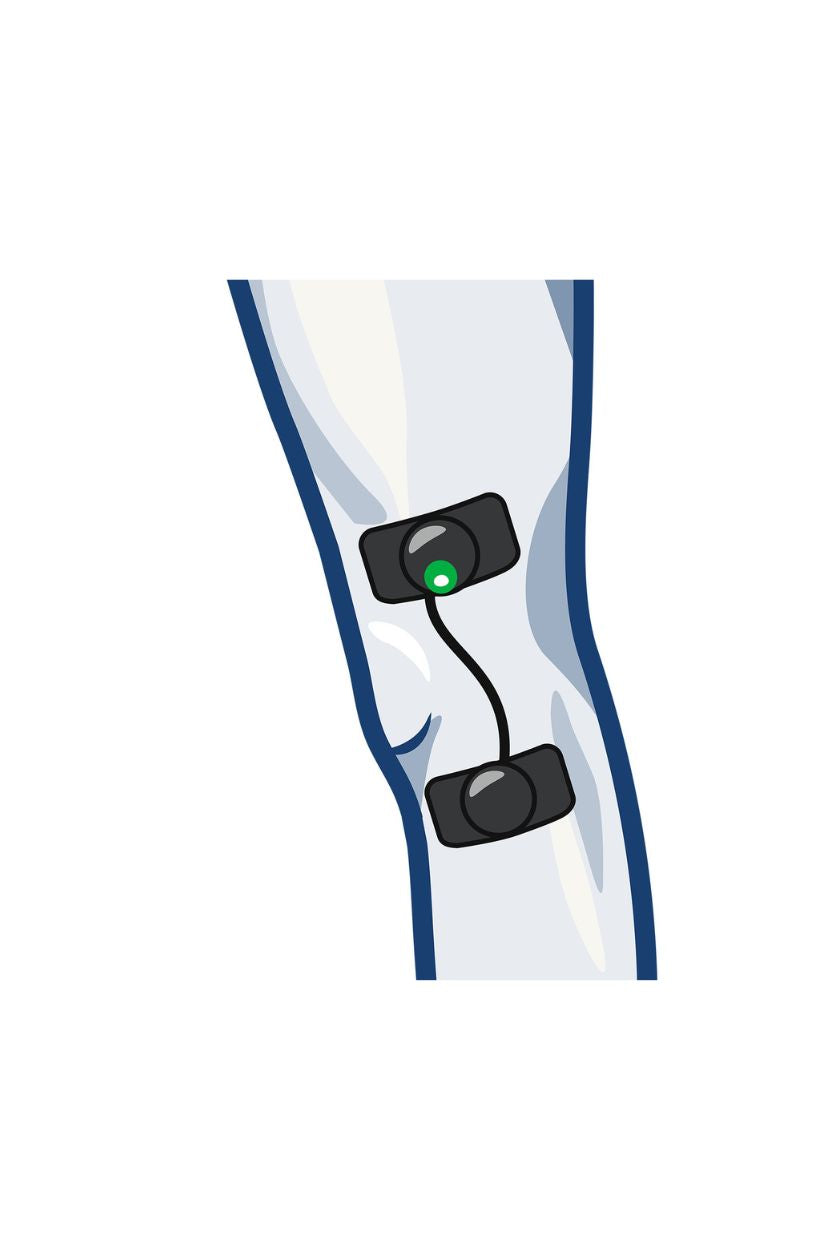 Knee (outside) electrode placement for women with wireless Compex EMS muscle stimulator