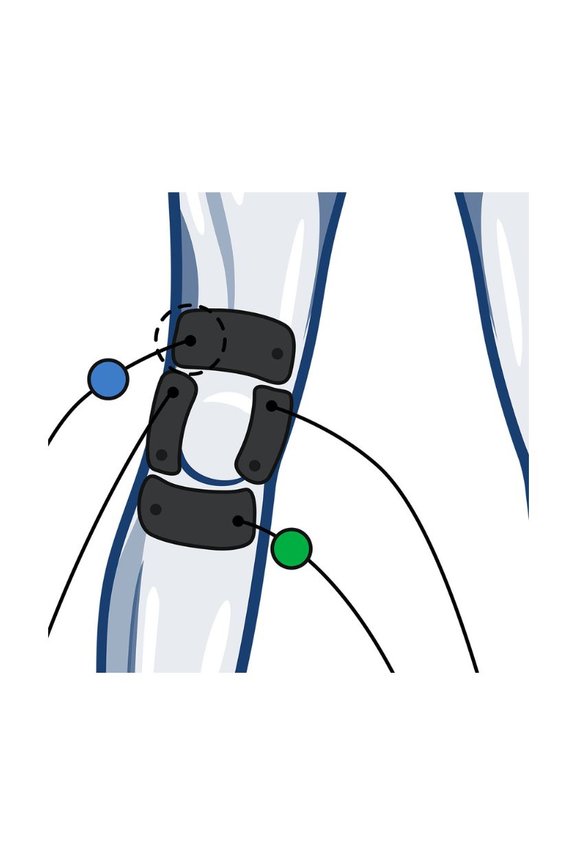 Knee electrode placement for women with wired Compex EMS muscle stimulator
