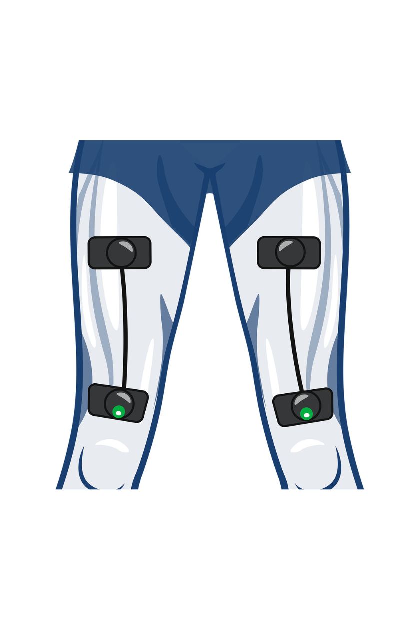 Quads (2 channels) electrode placement for women with wireless Compex EMS muscle stimulator